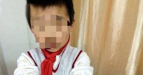 【閲覧注意】虐待を受けていた男の子の背中が痛々しい（画像）たった9歳の少年が受けてきた体の傷（中国）